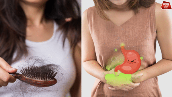 Hair Fall Problem